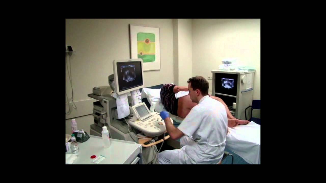 Accurate diagnosis of prostate cancer with ultrasound ...