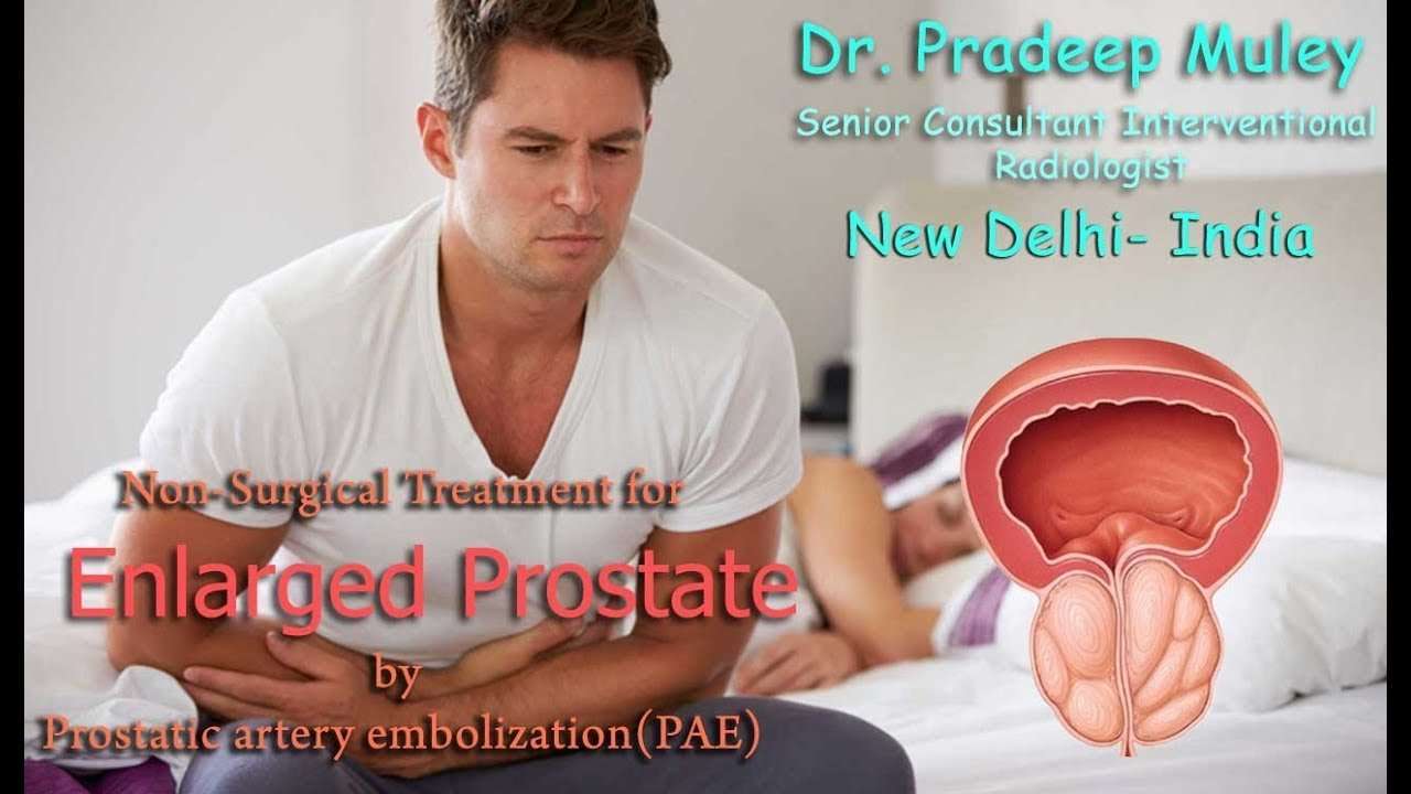 Best treatment options for enlarged prostate