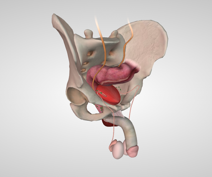 Blood In Stool After Prostate Surgery