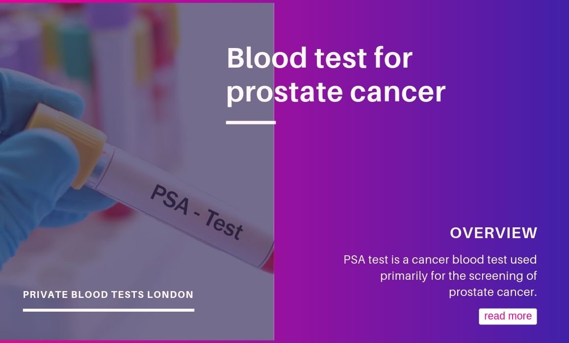 Blood Test for Prostate Cancer