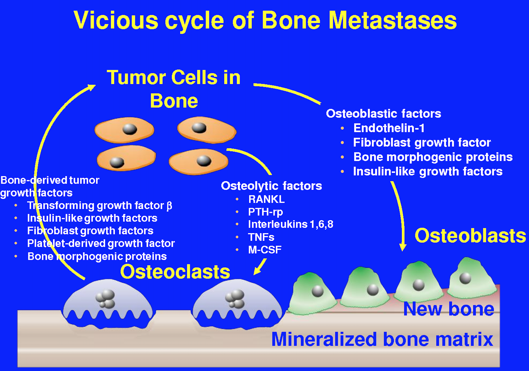 bone metastasis