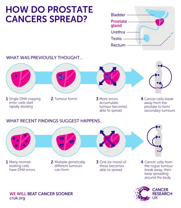 Does Prostate Cancer Spread