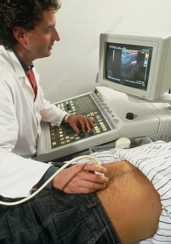Doppler ultrasound examination of the prostate