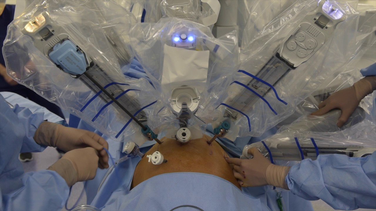 Dr Peter Swindle Performing a Robotic Prostatectomy