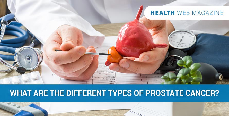 Everything You Need To Know About Types Of Prostate Cancer