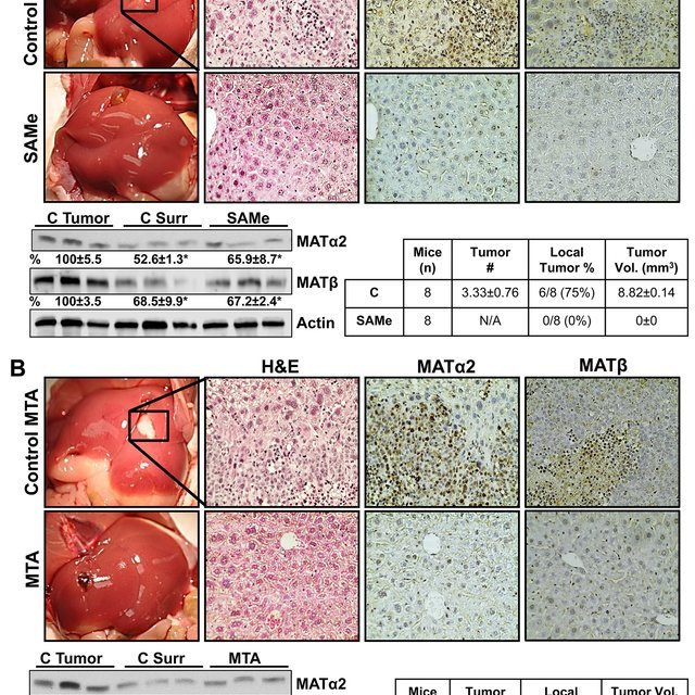 Expression of MAT2 and MAT in prostate and pancreatic ...