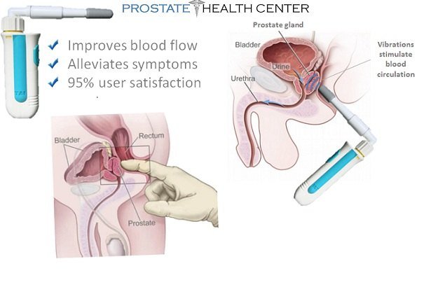 External Prostate Massage Techniques