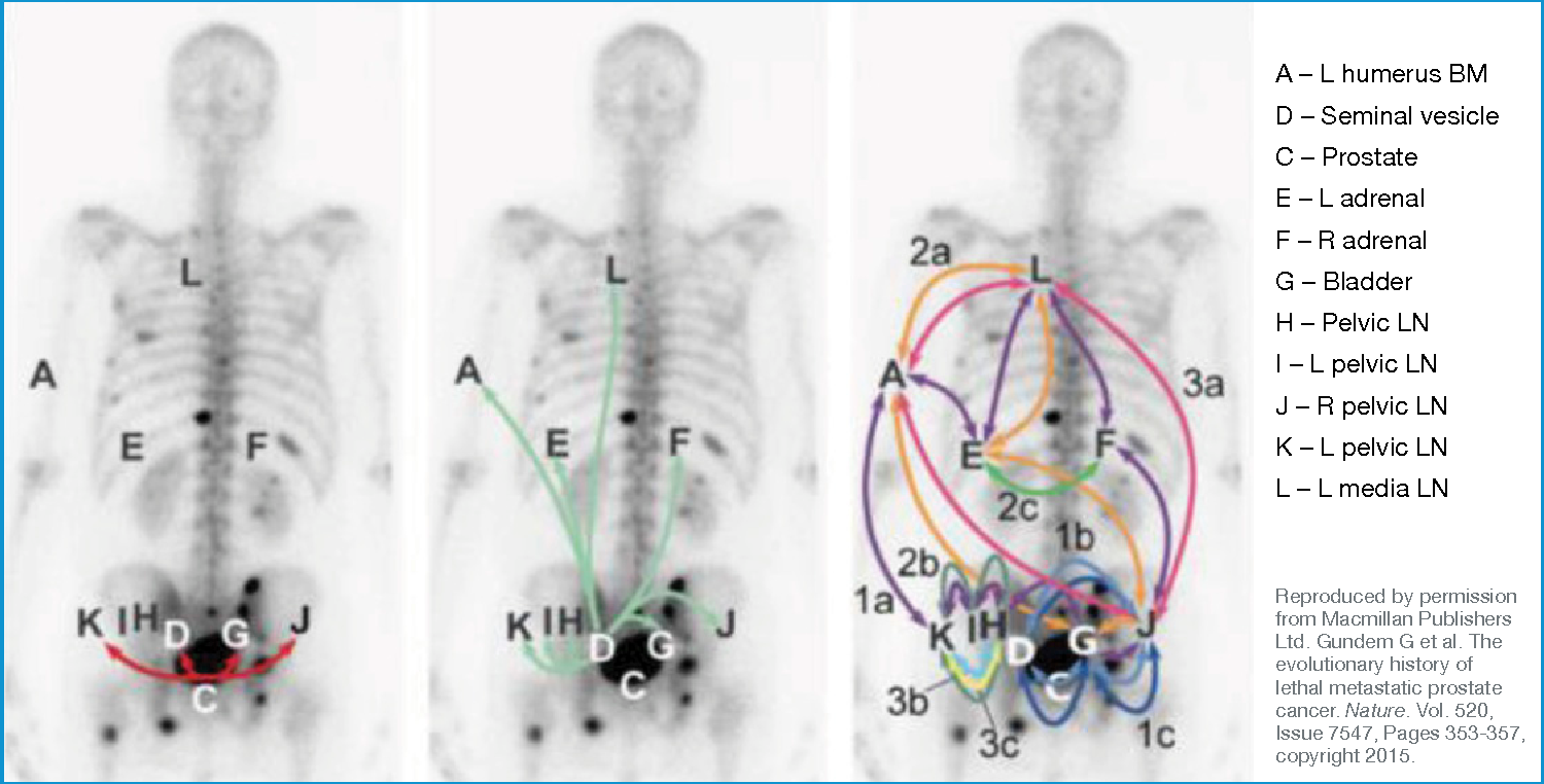 Figure 3 from Bone Metastases & Mortality in Prostate ...