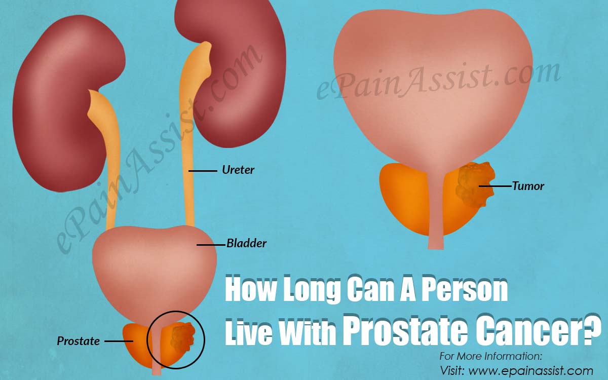 How Long Can A Person Live With Prostate Cancer?