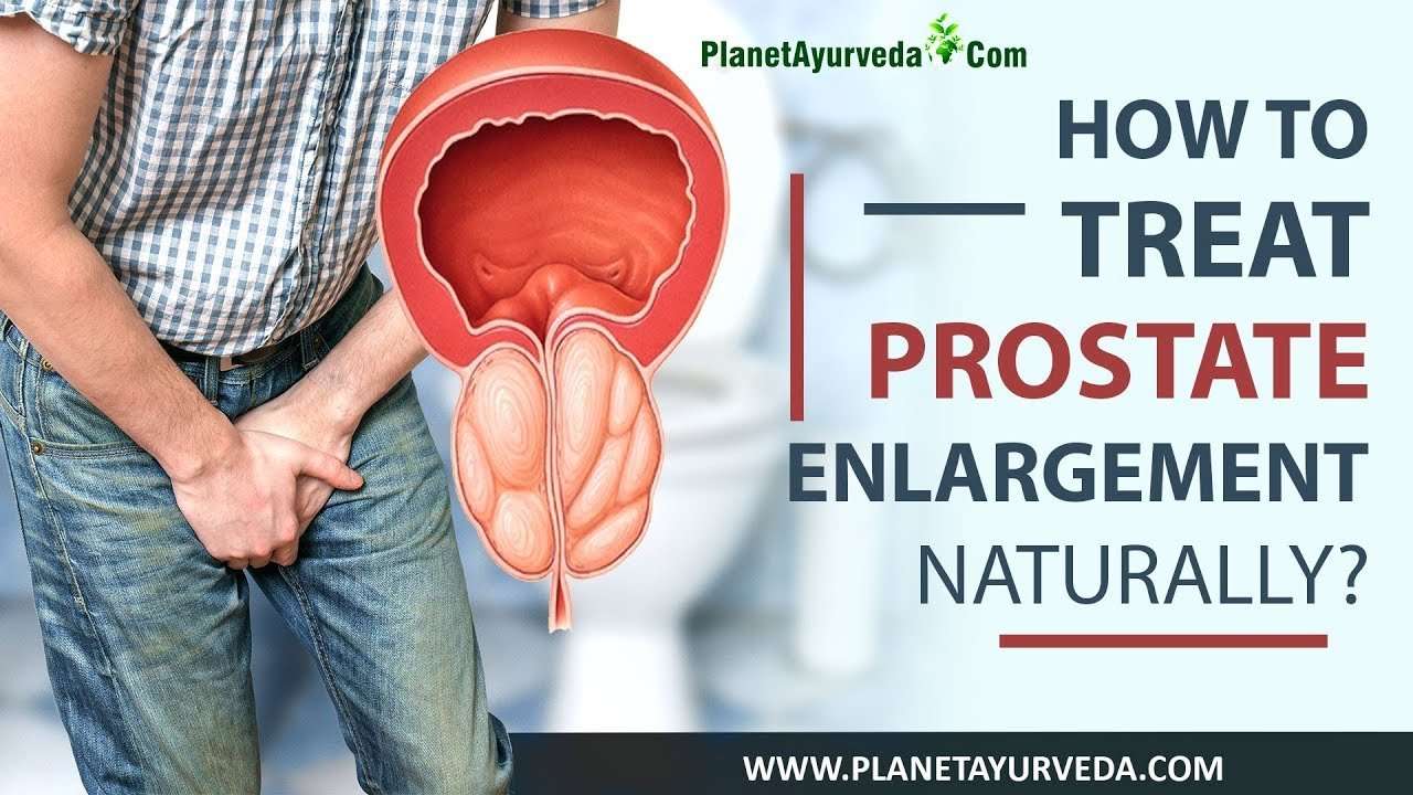 How to Treat Prostate Enlargement Naturally
