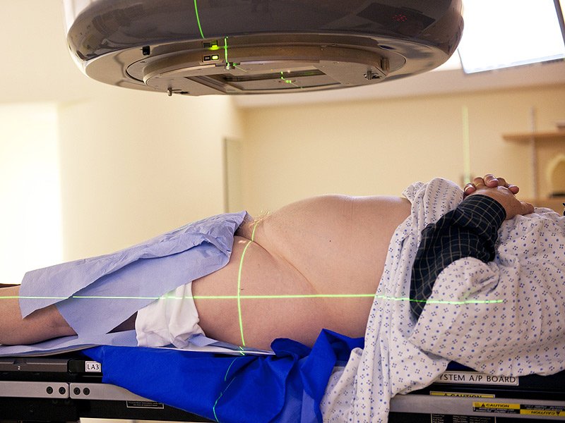 hypofractionated radiation therapy / Photo credits: MedScape