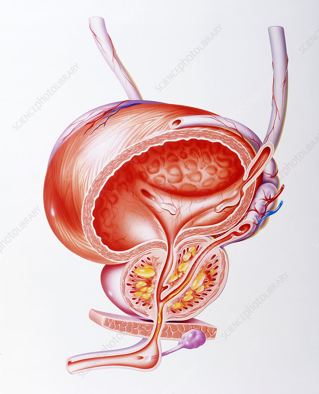 Illustration showing inflamed prostate gland