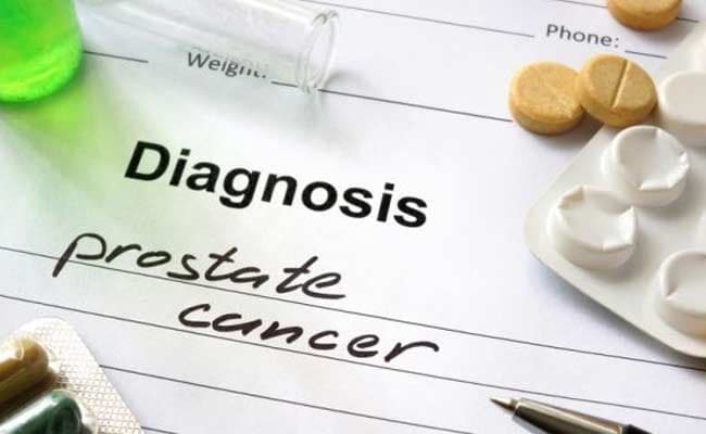 Men Who Have Prostate Tumour Can Live Without Any ...