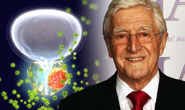 Michael Parkinson health: Prostate cancer diagnosis came ...