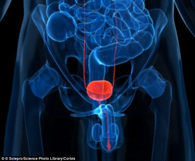 New blood test can find aggressive prostate cancer tumours ...