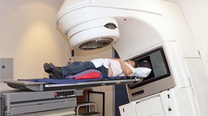 New Prostate Cancer Guideline Offers Shortened Radiation Time