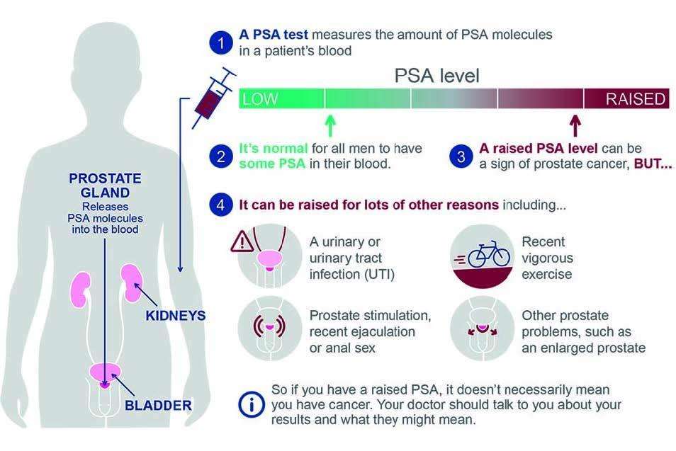PHE PSA prostate cancer test guideline