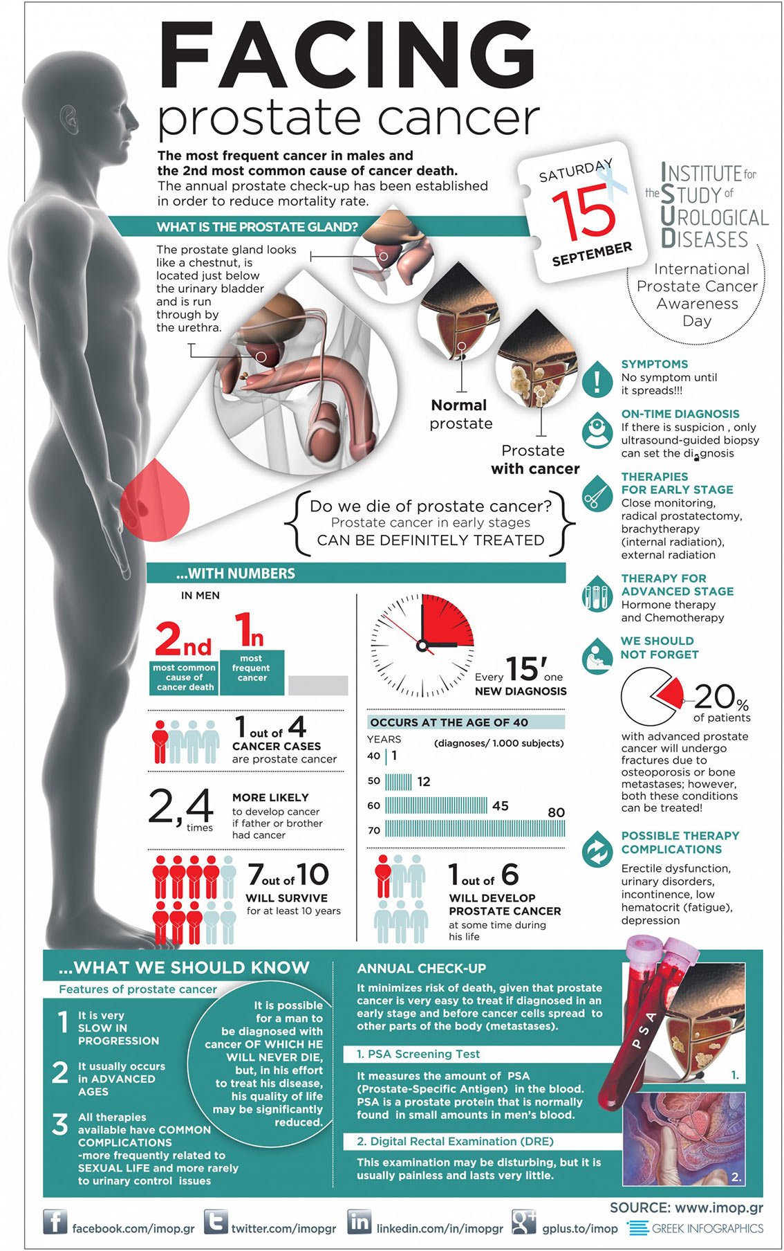 Prostate Cancer: Facts and Statistics [Infographic]