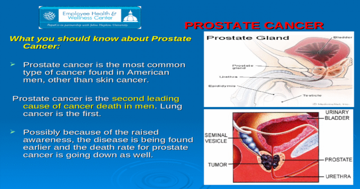 PROSTATE CANCER PROSTATE CANCER What you should know about ...