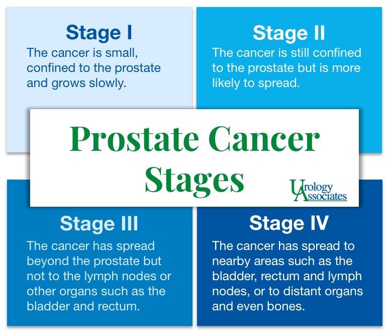 Final Stages Of Prostate Cancer - HealthyProstateClub.com