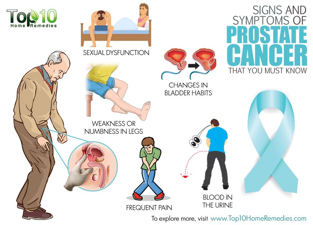 Prostate Cancer Symptoms all Men Should Know