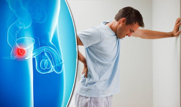 Prostate cancer symptoms: Man reveals back ache was sign ...