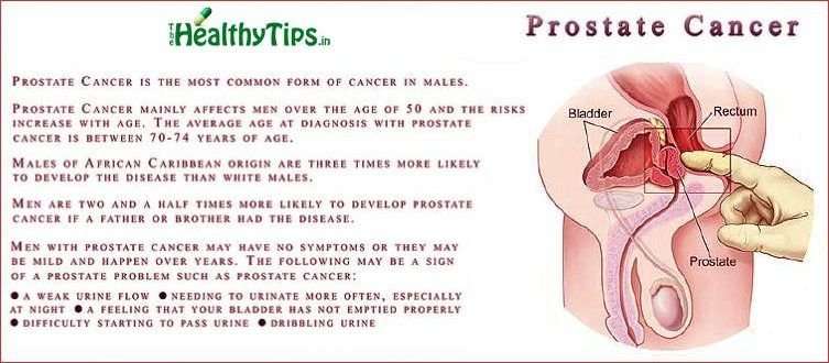 Prostate Cancer Symptoms Prognosis