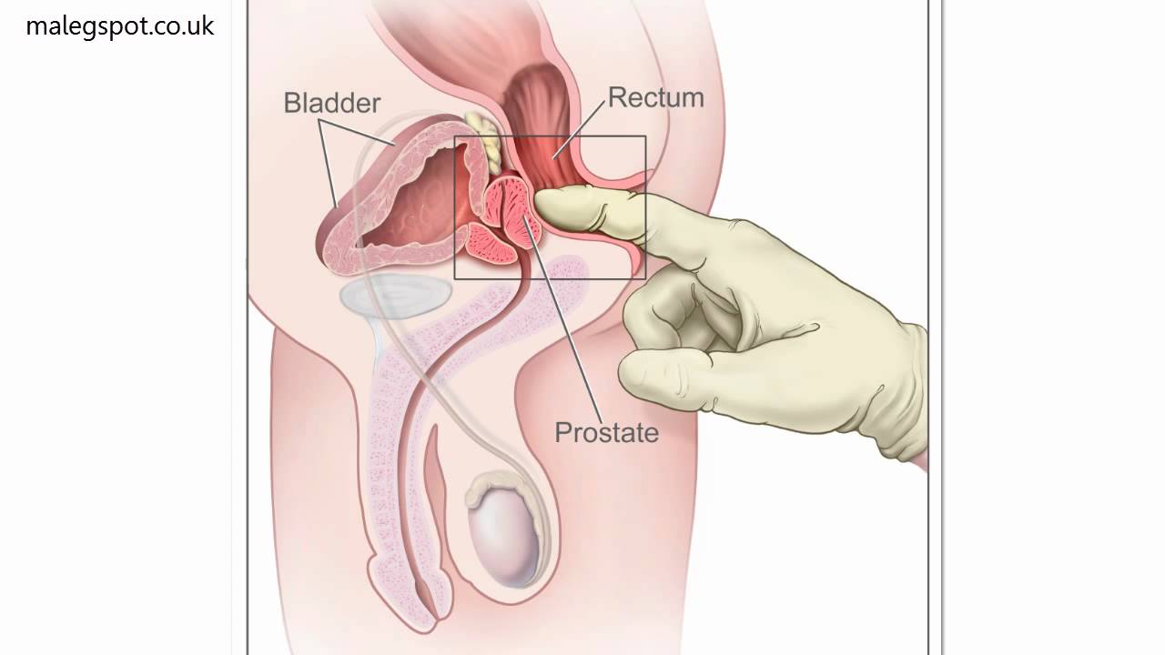 Prostate Orgasm: Do Men Know About The Prostate Orgasm ...