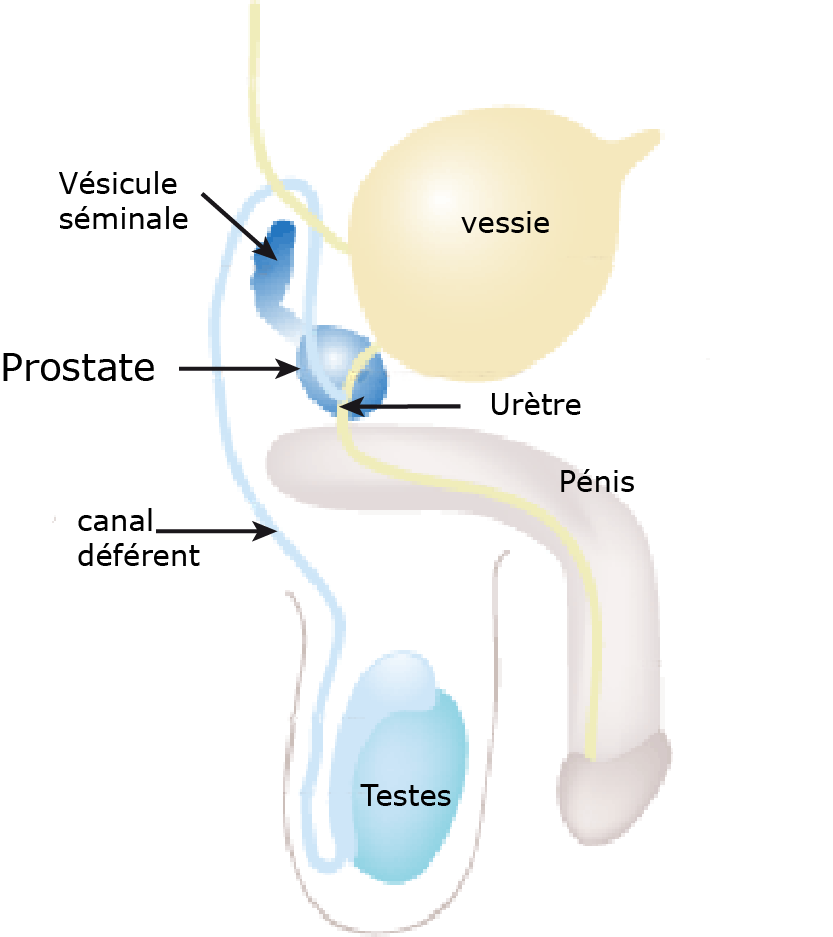 Prostate  SeleXel
