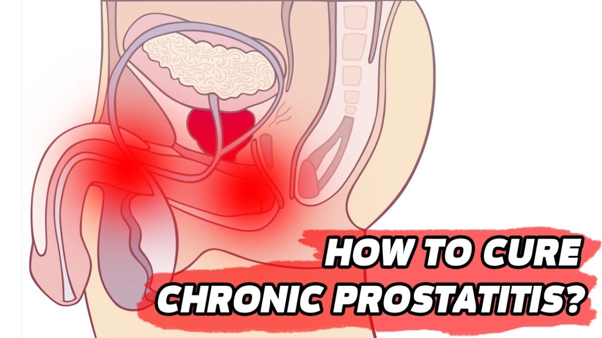 The Benefits of Self Prostate Massage for Prostatitis