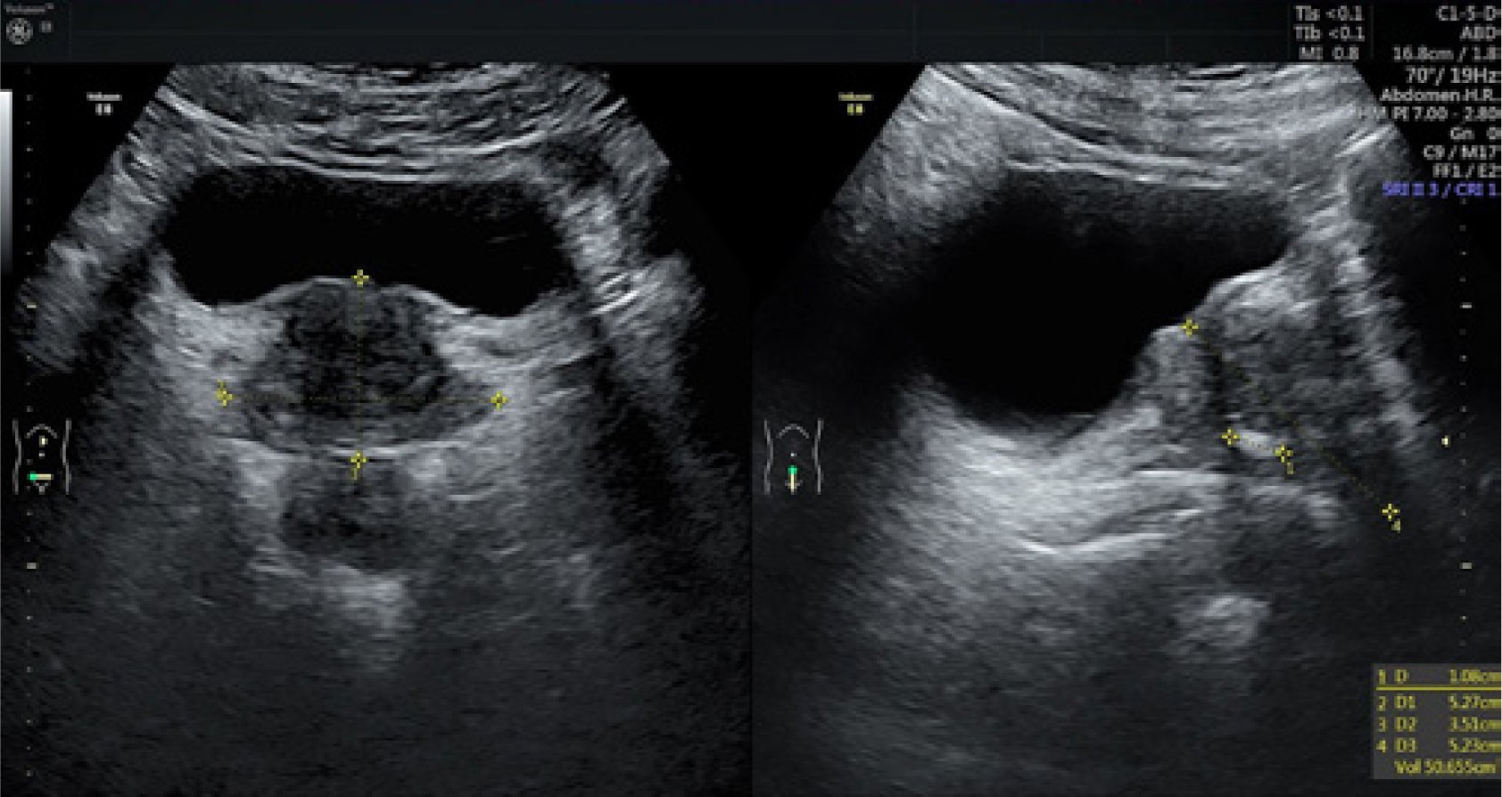 The standards of an ultrasound examination of the prostate ...