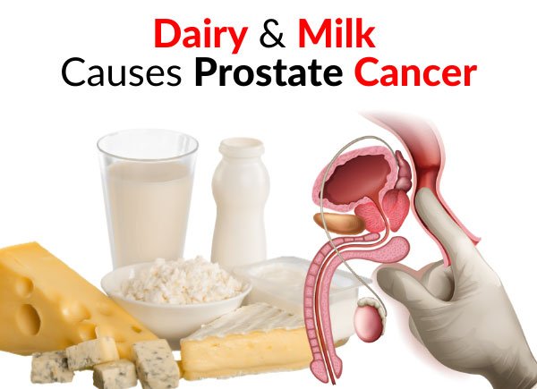 WARNING: Dairy &  Milk Causes Prostate Cancer