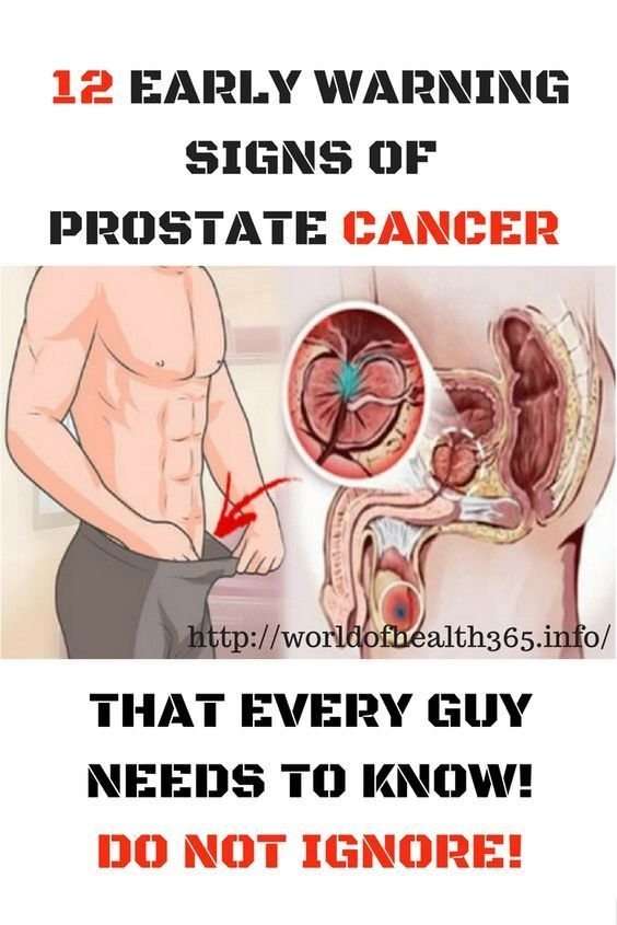 What Are Signs Of Having Prostate Cancer : 5 Early ...