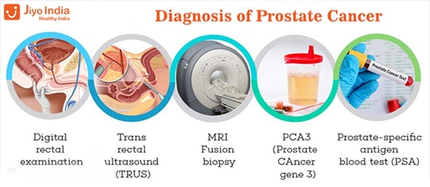 What are the most common earliest symptoms of prostate ...