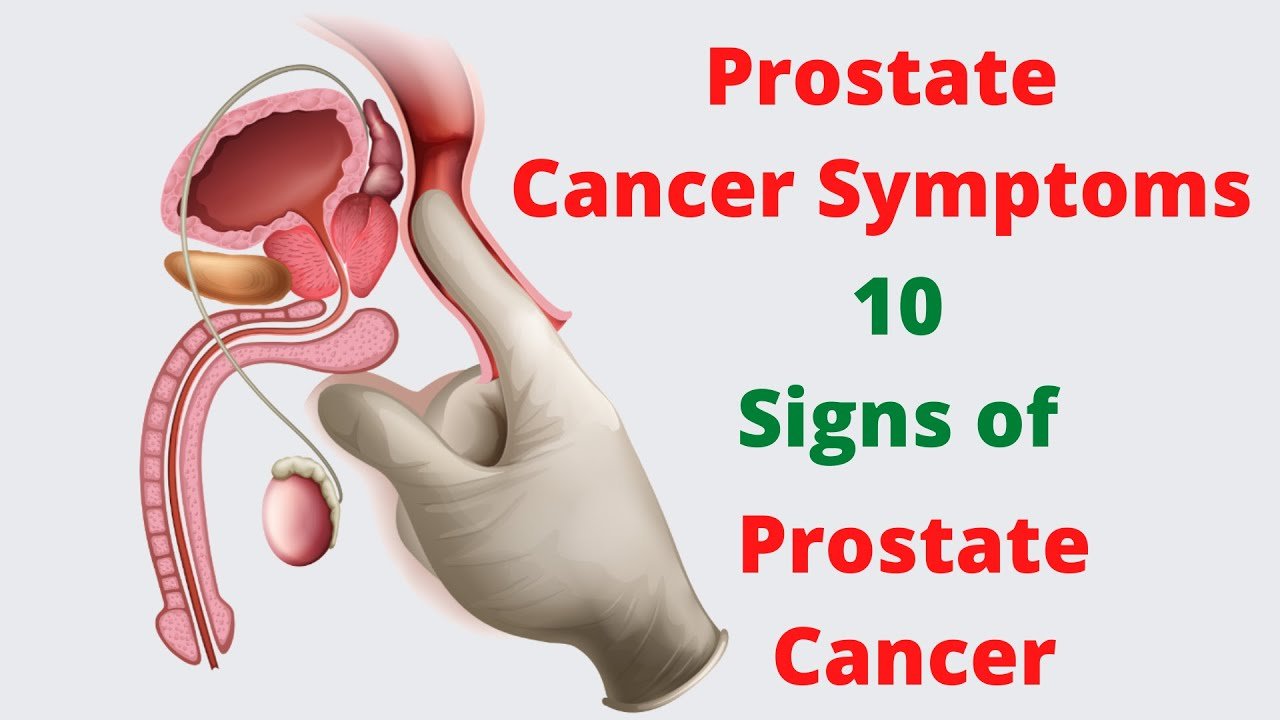 What Are The Signs Of Foot Cancer / Prostate Cancer ...