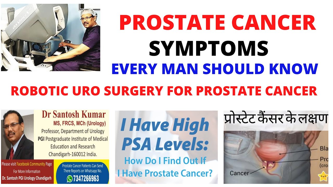 What is prostate cancer? Information about prostate cancer ...