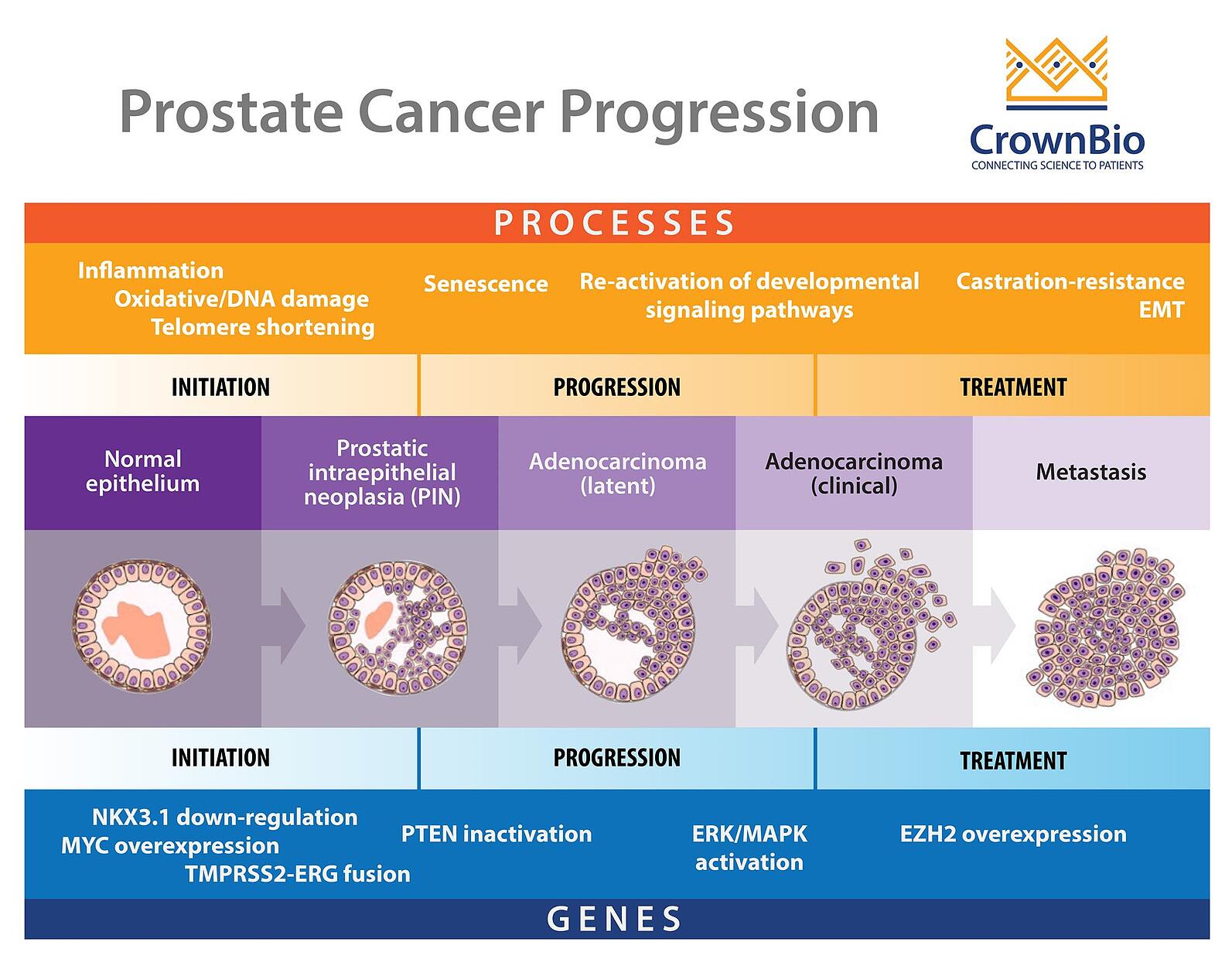 Why Are Prostate Cancer Preclinical Models Hard to Develop?